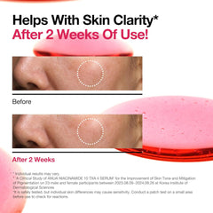 Serum 10% Niacinamide + 4% Tranexamic Fragrance-Free